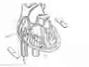 Fig. 01 - Apparatus and method for cardioversion