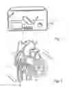 Fig. 02 - Apparatus and method for cardioversion