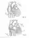 Fig. 04 - Apparatus and method for cardioversion