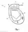 Fig. 02 - Implantable medical device feedthrough assembly having a coated conductor