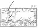 Fig. 01 - Radiation separating shield for skin treatment