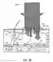 Fig. 03 - Radiation separating shield for skin treatment