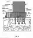 Fig. 04 - Radiation separating shield for skin treatment