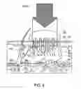 Fig. 06 - Radiation separating shield for skin treatment