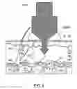 Fig. 07 - Radiation separating shield for skin treatment