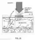 Fig. 17 - Radiation separating shield for skin treatment