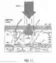 Fig. 19 - Radiation separating shield for skin treatment