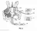 Fig. 03 - Switched photodynamic therapy apparatus and method