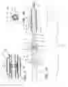 Fig. 02 - Bifurcation stent delivery catheter assembly and method
