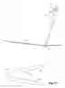 Fig. 06 - Laparoscopic vascular access