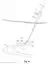 Fig. 08 - Laparoscopic vascular access