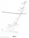 Fig. 10 - Laparoscopic vascular access