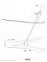 Fig. 16 - Laparoscopic vascular access