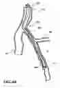 Fig. 08 - Temporary absorbable venous occlusive stent and superficial vein treatment method