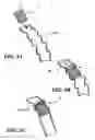 Fig. 04 - Temporary absorbable venous occlusive stent and superficial vein treatment method