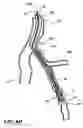 Fig. 10 - Temporary absorbable venous occlusive stent and superficial vein treatment method