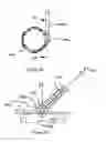 Fig. 12 - Expandable annuloplasty ring and associated ring holder