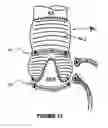Fig. 28 - Expandable annuloplasty ring and associated ring holder