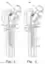 Fig. 02 - Orthopaedic prosthesis having a superparamagnetic material and associated method