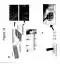Fig. 18 - Substantially decellularized grafts from umbilical cord vessels and process for preparing and using same