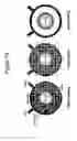 Fig. 21 - Substantially decellularized grafts from umbilical cord vessels and process for preparing and using same