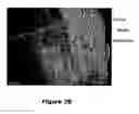 Fig. 28 - Substantially decellularized grafts from umbilical cord vessels and process for preparing and using same