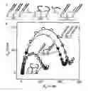 Fig. 01 - Nucleic acid mismatich detection