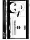 Fig. 35 - Methods of providing a patient with aesthetic improvement procedures
