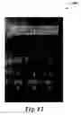 Fig. 14 - Phonetic input using a keypad