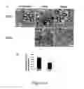 Fig. 05 - Animal models for demyelination disorders