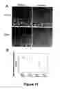 Fig. 12 - Animal models for demyelination disorders