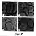 Fig. 38 - Animal models for demyelination disorders