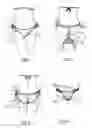 Fig. 02 - Convertible swimsuit bottom or pair of briefs