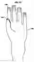 Fig. 06 - Grip enhancing structure having vacuum adhesion micro, miniature_suction cups and method and apparatus for making same