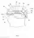 Fig. 07 - Mounting system for accessories on a safety helmet