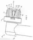 Fig. 02 - Electric toothbrush head
