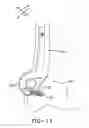 Fig. 15 - Dirt separation system for a vacuum cleaner