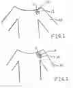 Fig. 02 - Attachable magnetic clip and system