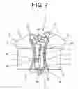 Fig. 08 - Slide fastener