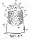 Fig. 20 - Article of footwear having an upper with a matrix layer