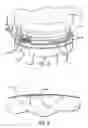 Fig. 04 - Visual display