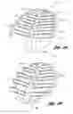 Fig. 07 - Gas-liquid impingement separators