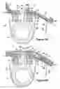 Fig. 06 - Lockout device