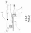 Fig. 04 - Saxophone key