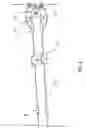 Fig. 03 - Binary track safety traverse system reconfigurable to provide safe trajectories over a greater range of inclinations