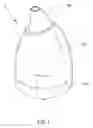 Fig. 02 - Atomizer used for facial treatment