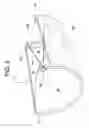 Fig. 04 - Air cannon apparatus and method