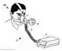 Fig. 01 - Apparatus for non-invasive mechanical ventilation