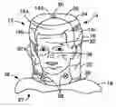 Fig. 01 - Convertible respiratory hood assembly