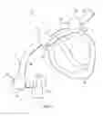 Fig. 02 - System and method for securing a gas delivery mask onto a subject's head